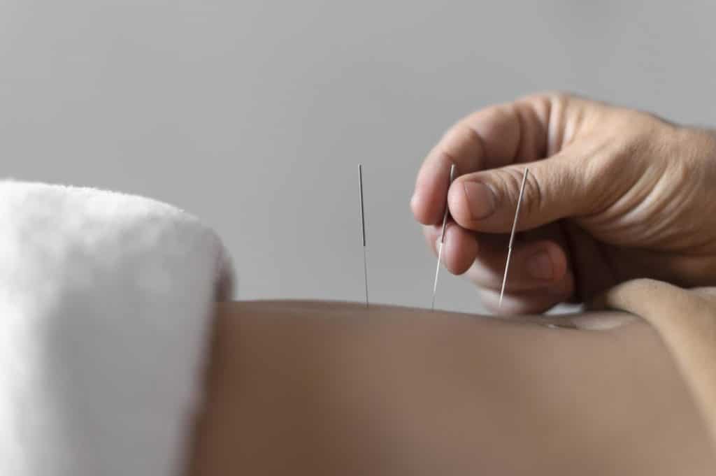 close up hand holding acupuncture needle