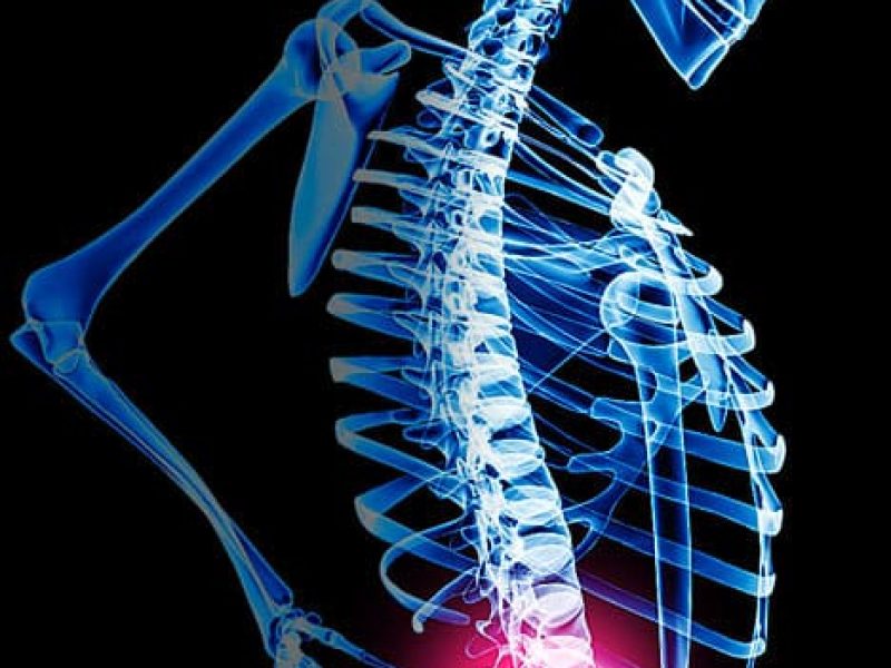 Back pain explained