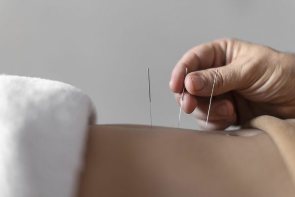 close up hand holding acupuncture needle