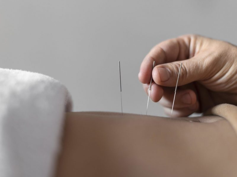 close up hand holding acupuncture needle